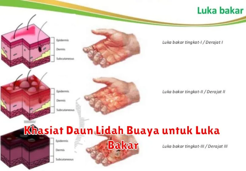 Khasiat Daun Lidah Buaya untuk Luka Bakar